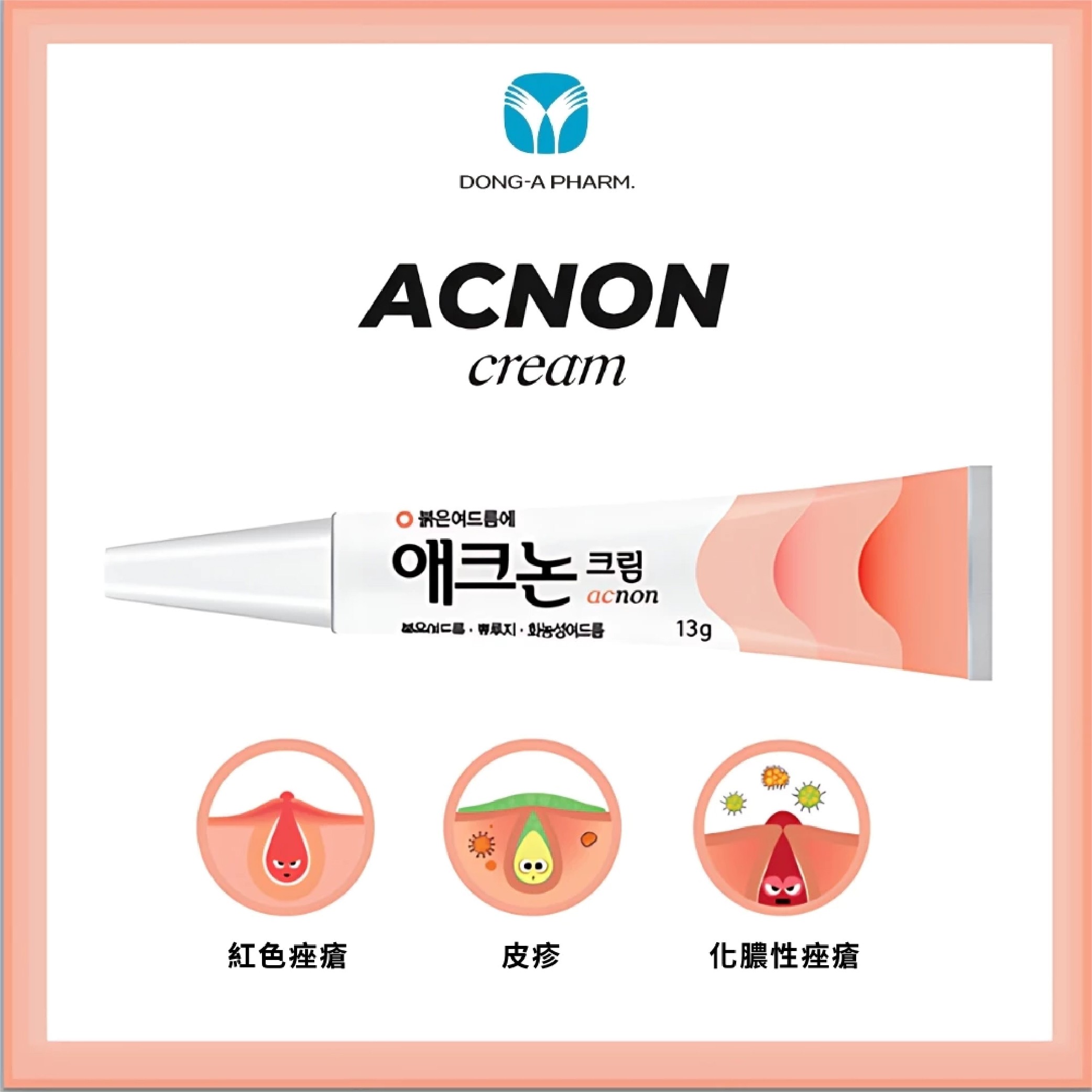 Acnon祛痘乳膏(粉) 13g